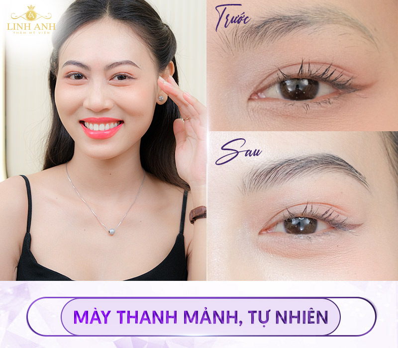 công nghệ phun mày tán bột hàn quốc