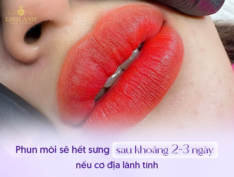 hình ảnh xăm môi bị sưng