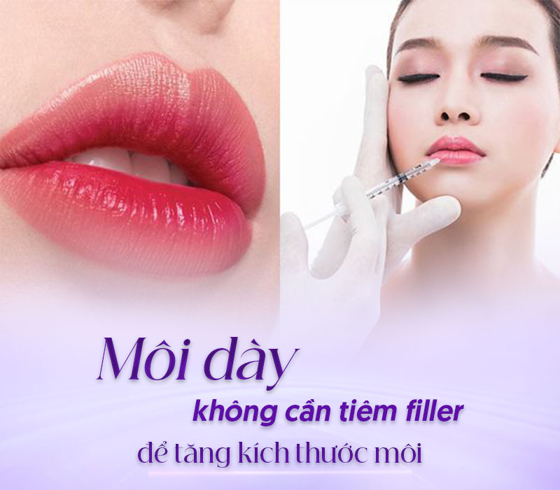 môi dày tiêm filler được không