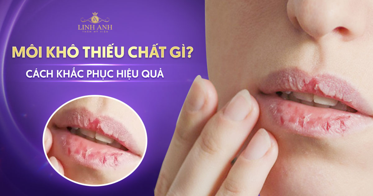 Môi khô thiếu chất gì? Cách khắc phục môi khô nứt nẻ hiệu quả