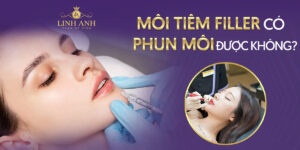 môi tiêm filler có phun được không - Viện thẩm mỹ quốc tế Linh Anh