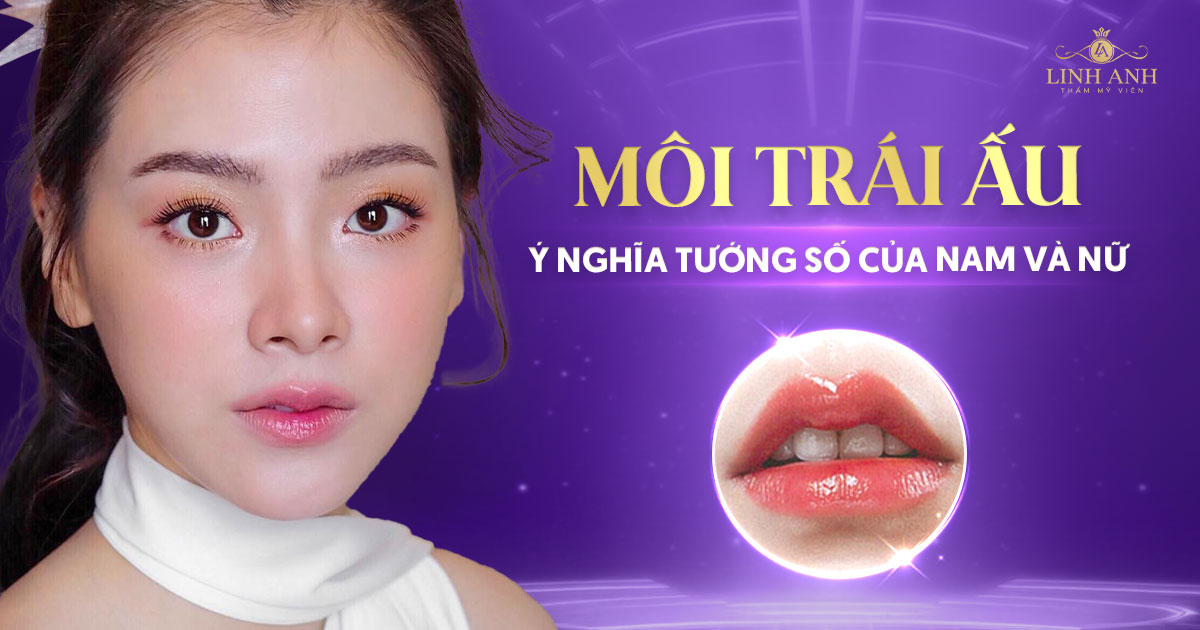 Tướng số môi trái ấu ở Đàn ông, Phụ nữ như thế nào?