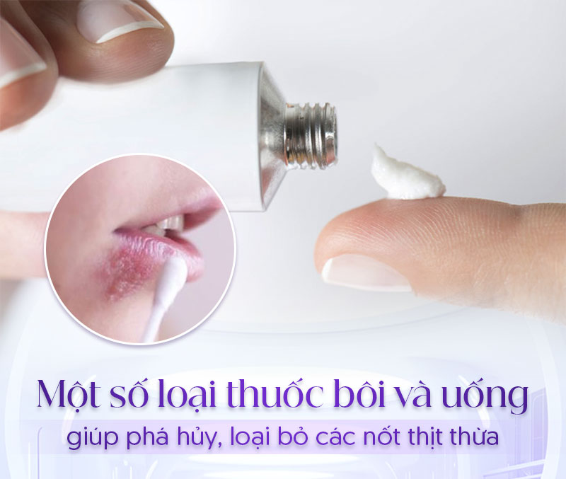 mụn thịt ở môi do đâu