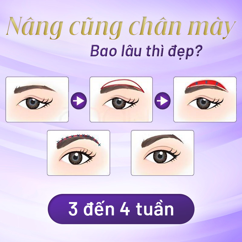 nâng cung chân mày là như thế nào