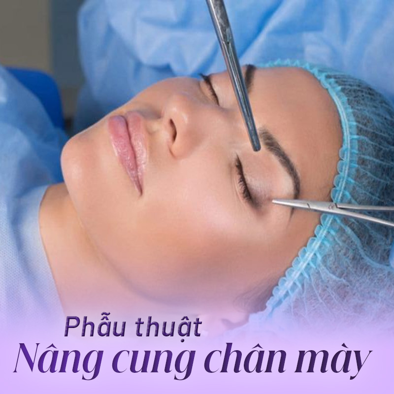 nâng cung lông mày