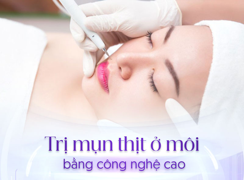 nguyên nhân gây mụn thịt ở môi