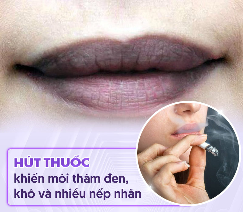 Hút thuốc là nguyên nhân khiến môi bị thâm đen ở nam giới.
