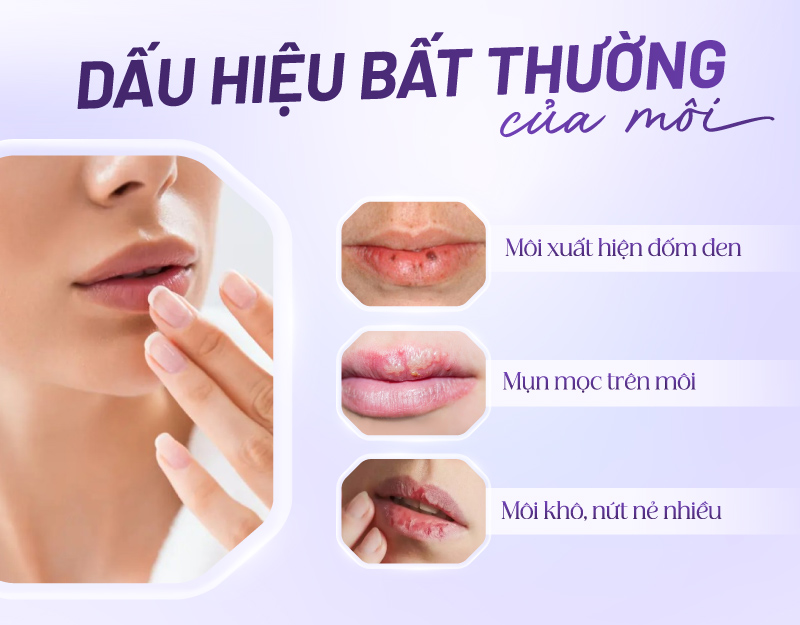 nguyên nhân khiến môi nhợt nhạt