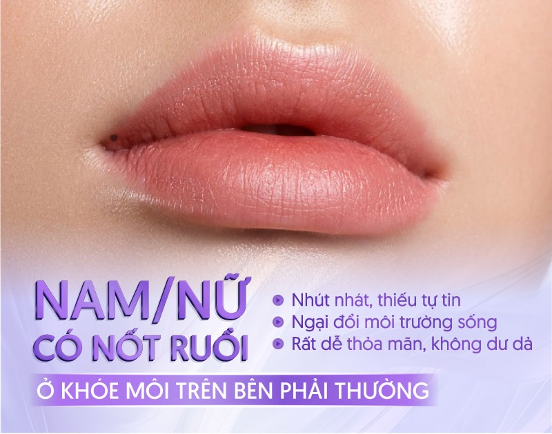 Nốt ruồi ở viền môi bên phải