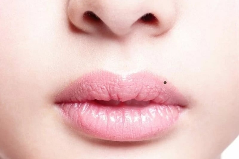 Nốt ruồi ở viền môi trên bên trái