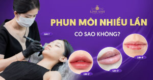 phun môi nhiều lần có sao không