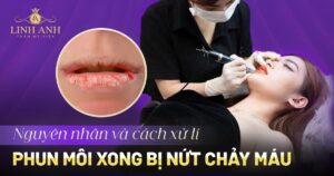 phun môi xong bị nứt chảy máu