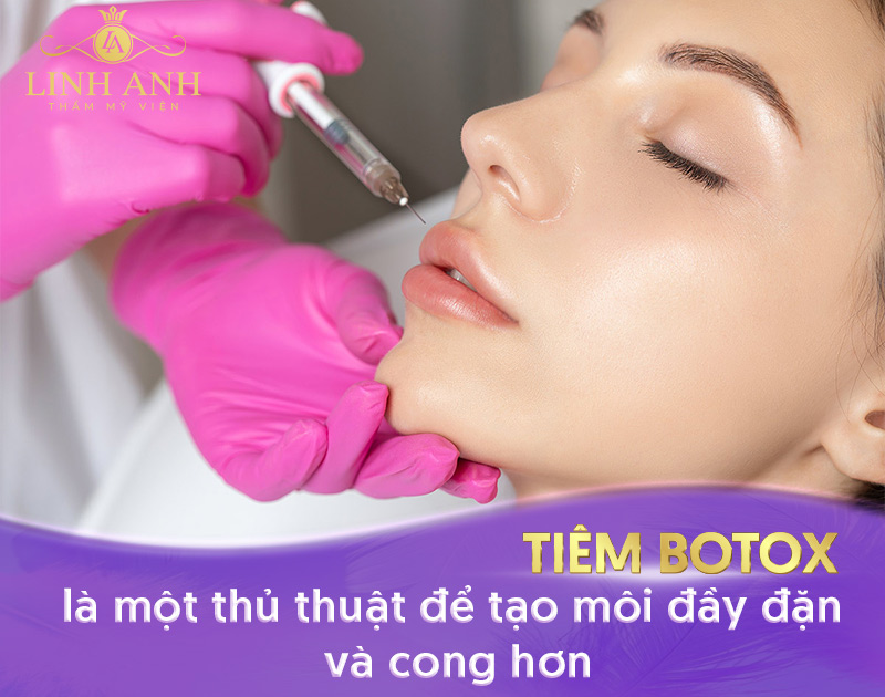 tiêm botox môi là gì