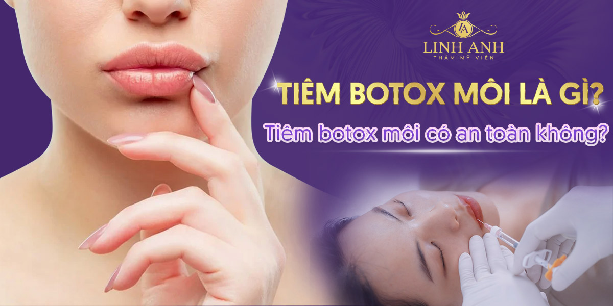 Tiêm botox môi là gì? Tiêm botox môi có an toàn không?