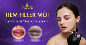 tiêm filler môi có ảnh hưởng gì không