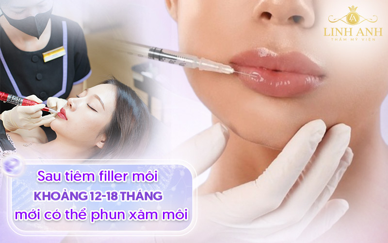 Môi tiêm filler có phun được không? Câu trả lời là không.