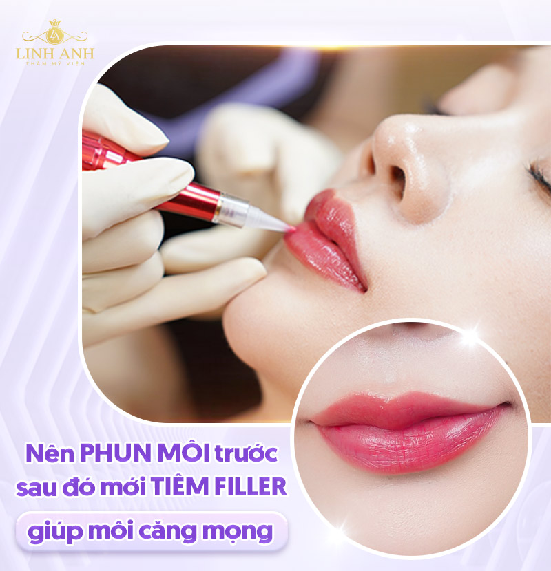 Nên phun môi trước hay tiêm filler trước?