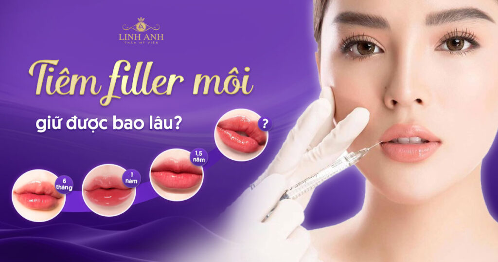 tiêm filler môi giữ được bao lâu