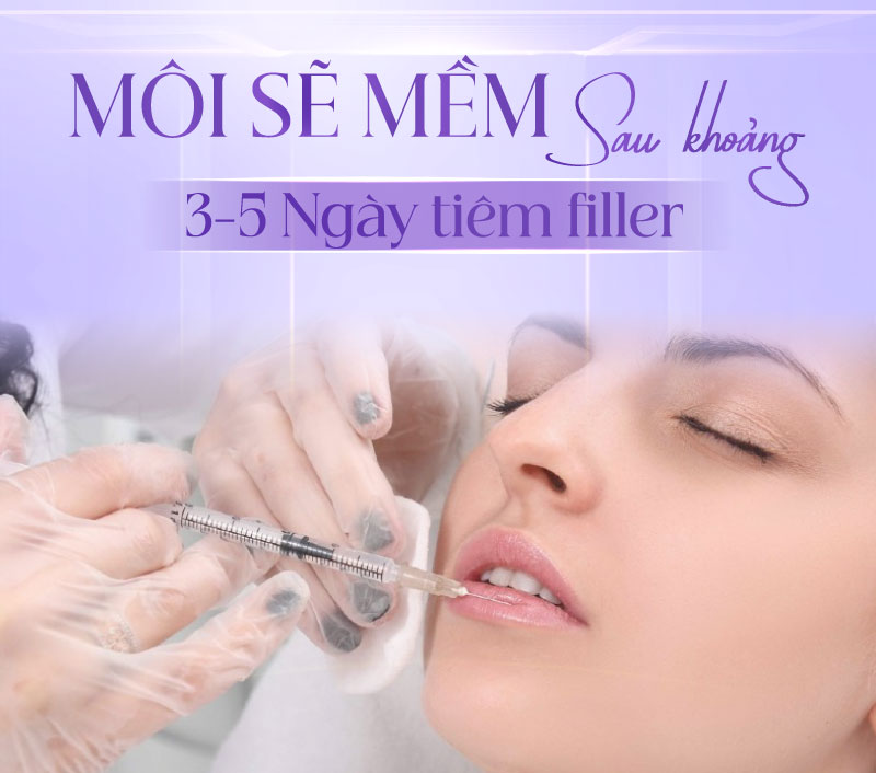 tiêm filler môi sau bao lâu thì mềm