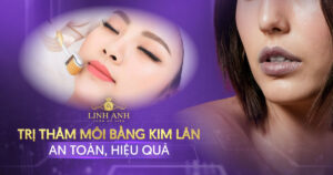 trị thâm môi bằng kim lăn