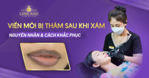 viền môi bị thâm sau khi xăm