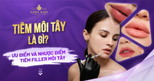 Tiêm môi tây
