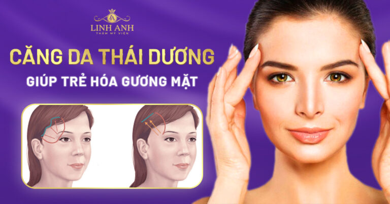 Căng da thái dương – Tuyệt chiêu trẻ hóa gương mặt hiệu quả