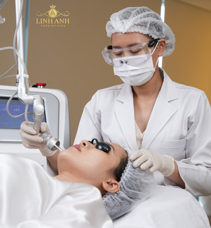 nốt ruồi ở đầu lông mày Dịch vụ tẩy nốt ruồi tại Linh Anh