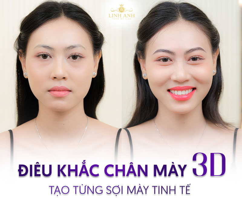 điêu khắc chân mày 3d là gì - Viện thẩm mỹ quốc tế Linh Anh