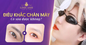 điêu khắc lông mày có xoá được không