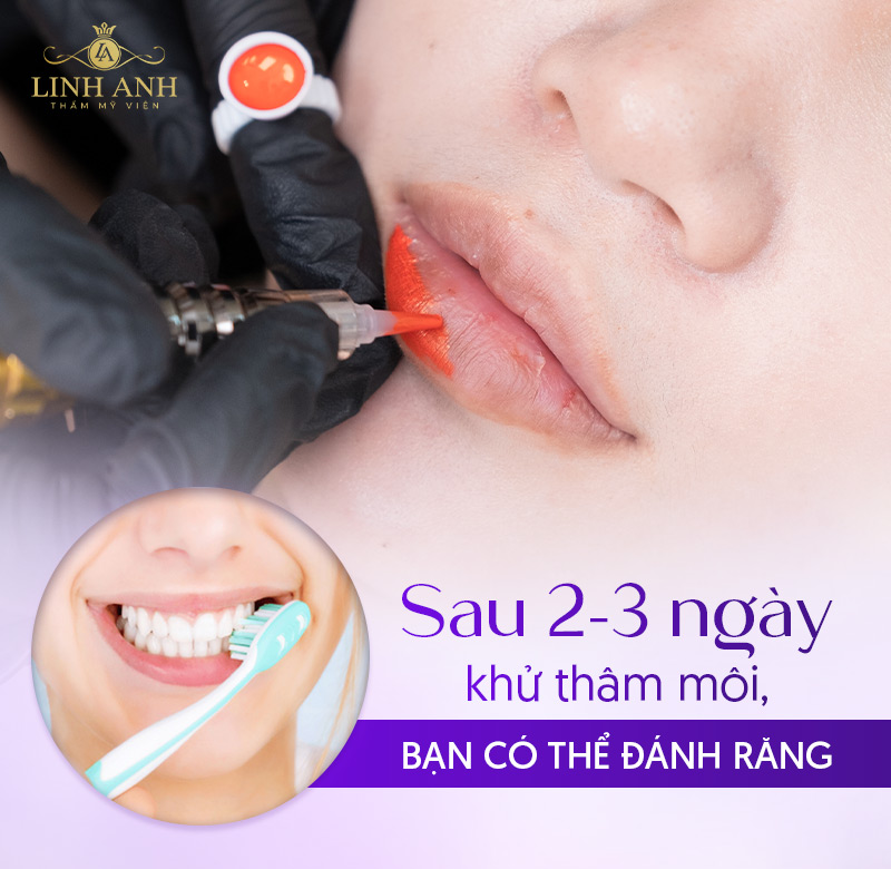 khử Thâm môi nên kiêng ăn gì