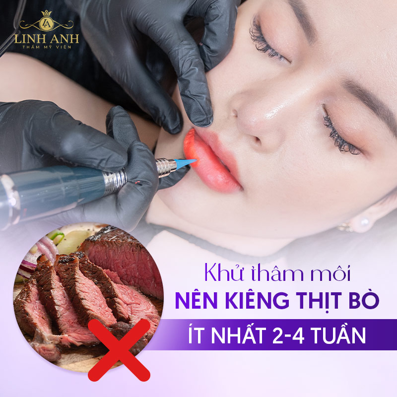 khử Thâm môi nên kiêng gì