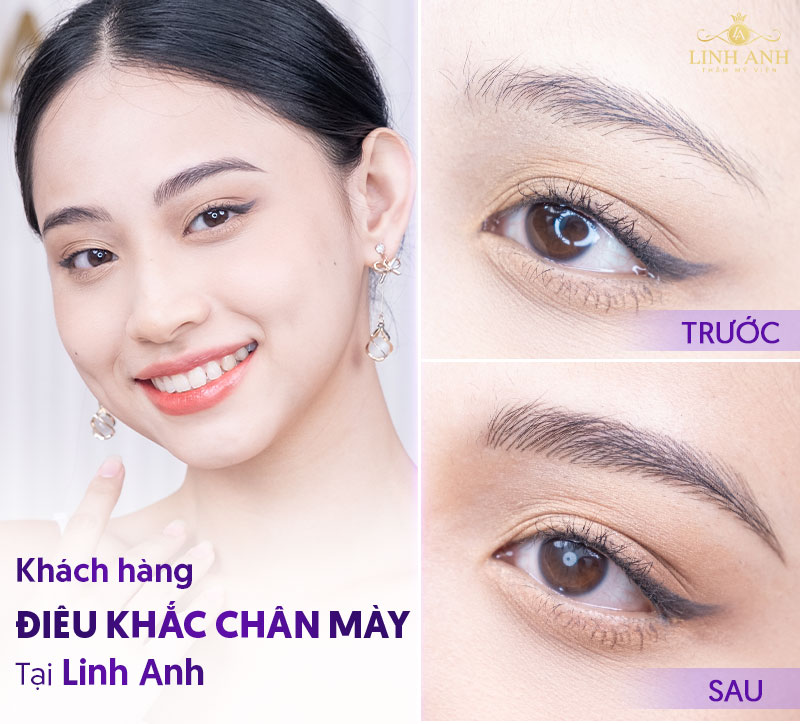 kỹ thuật điêu khắc mày 3D là gì - Viện thẩm mỹ quốc tế Linh Anh