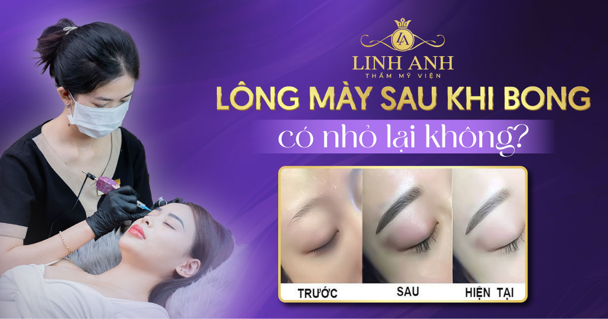 Lông mày sau khi bong có nhỏ lại không? Chuyên gia giải đáp