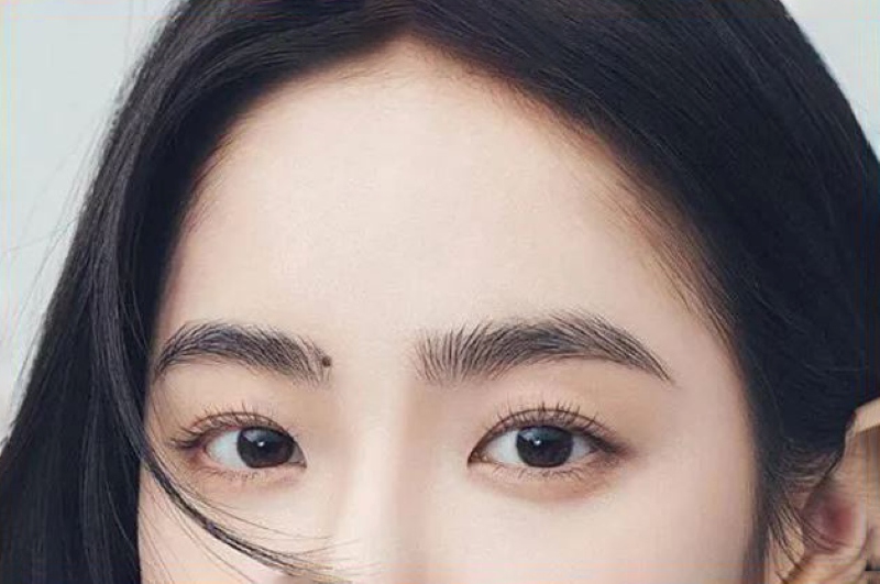Nốt ruồi ở đầu lông mày phải nữ