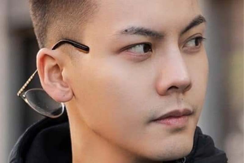 Nốt ruồi ở đuôi lông mày phải nam