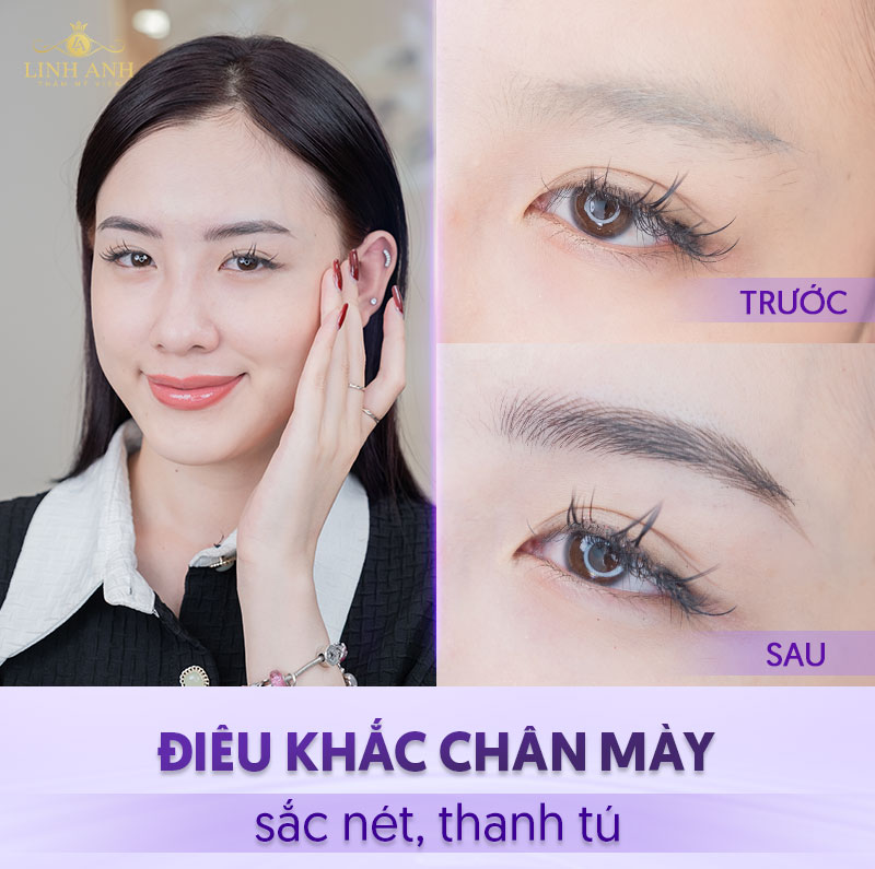 dịch vụ điêu khắc lông mày 8d là gì - Viện thẩm mỹ quốc tế Linh Anh