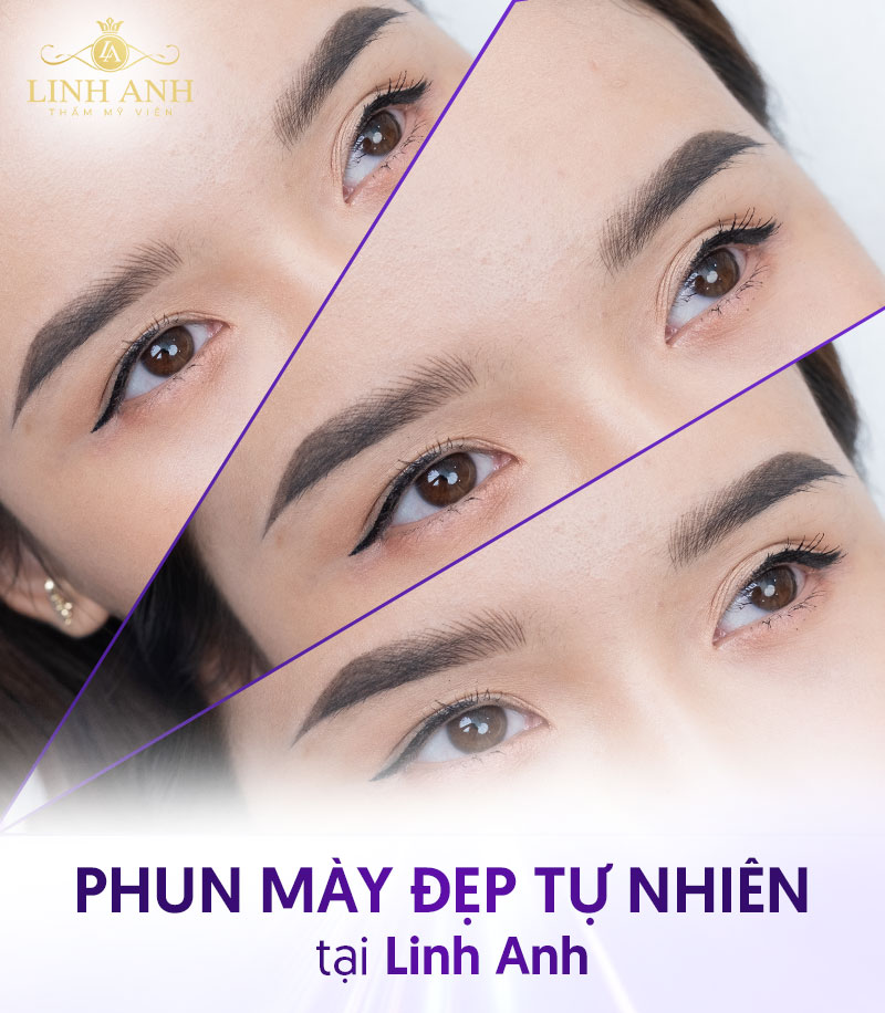 Phun tán bột lông mày kiêng gì - Viện thẩm mỹ quốc tế Linh Anh