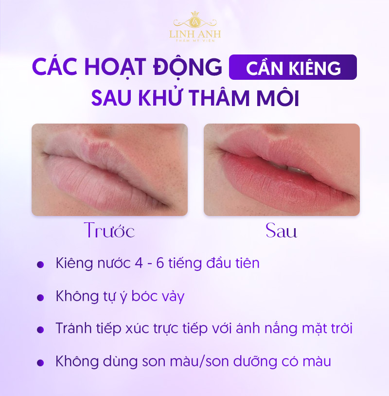 sau khi khử Thâm môi nên kiêng gì