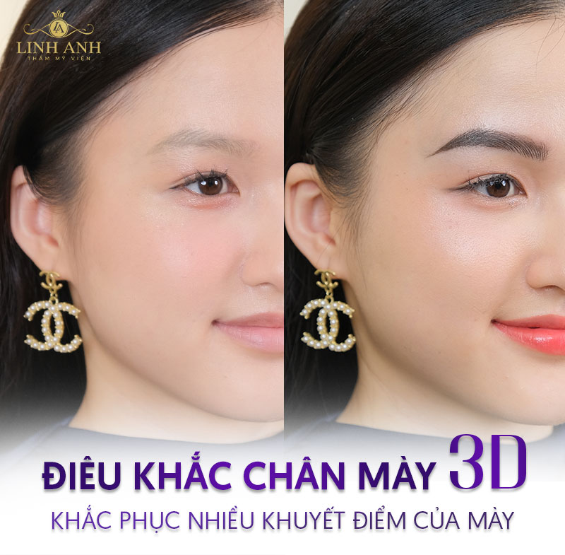 thẩm mỹ điêu khắc chân mày 3d - Viện thẩm mỹ quốc tế Linh Anh