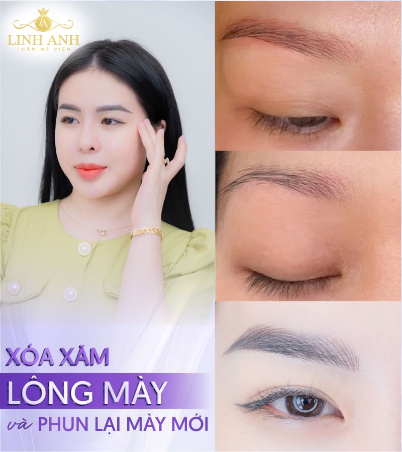 xoá chân mày bao lâu thì làm lại được