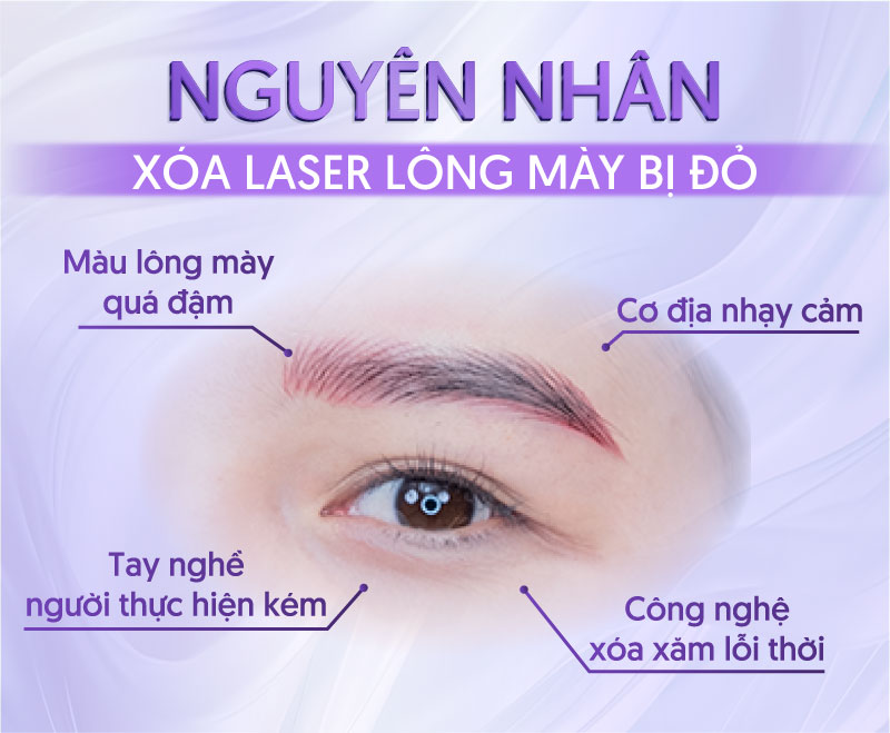 xóa laser lông mày bị đỏ là do đâu