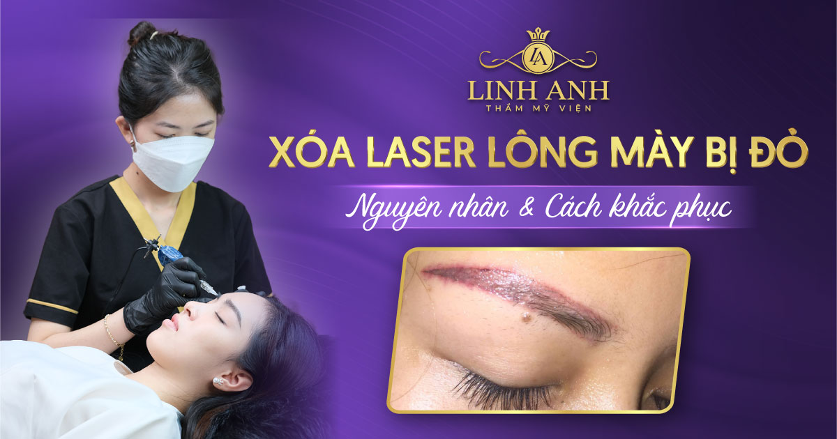 xóa laser lông mày bị đỏ