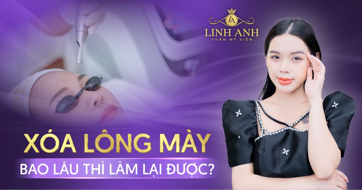 xoá lông mày bao lâu thì làm lại được