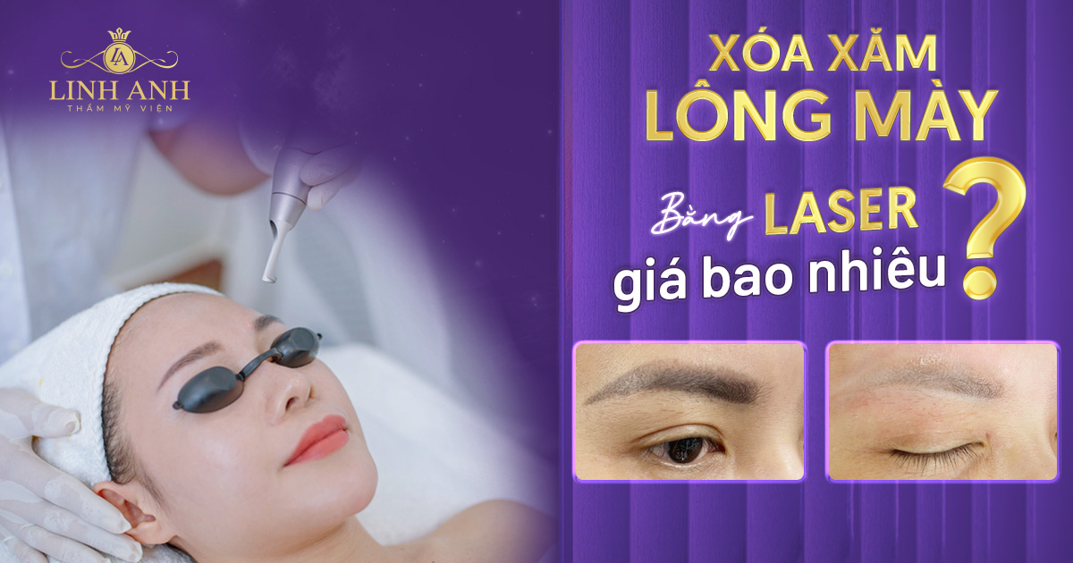 xóa xăm lông mày bằng laser giá bao nhiêu