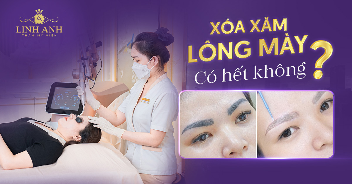 xóa xăm lông mày có hết không