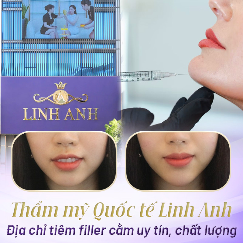 Giá tiêm cằm v line