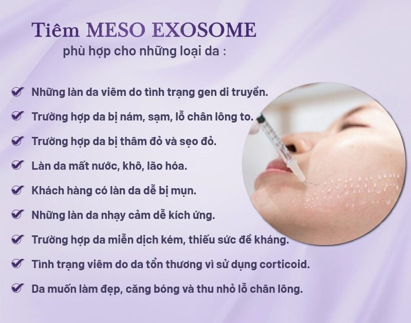 meso exosome asce giá bao nhiêu