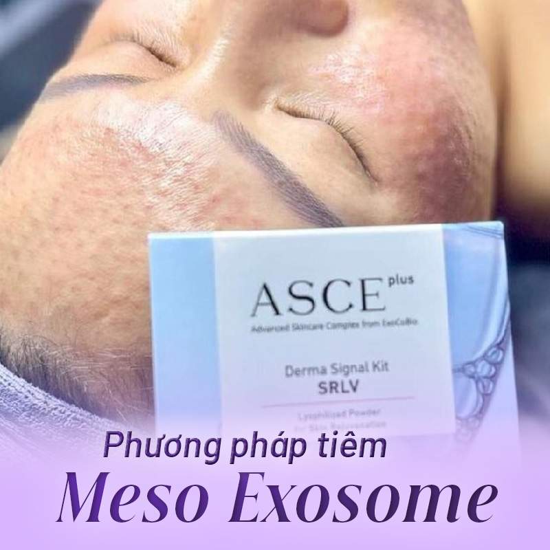 tiêm exosome giá bao nhiêu