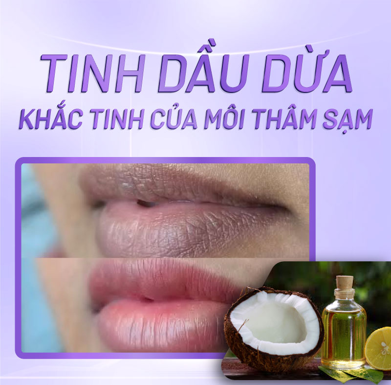 cách khử thâm môi bẩm sinh